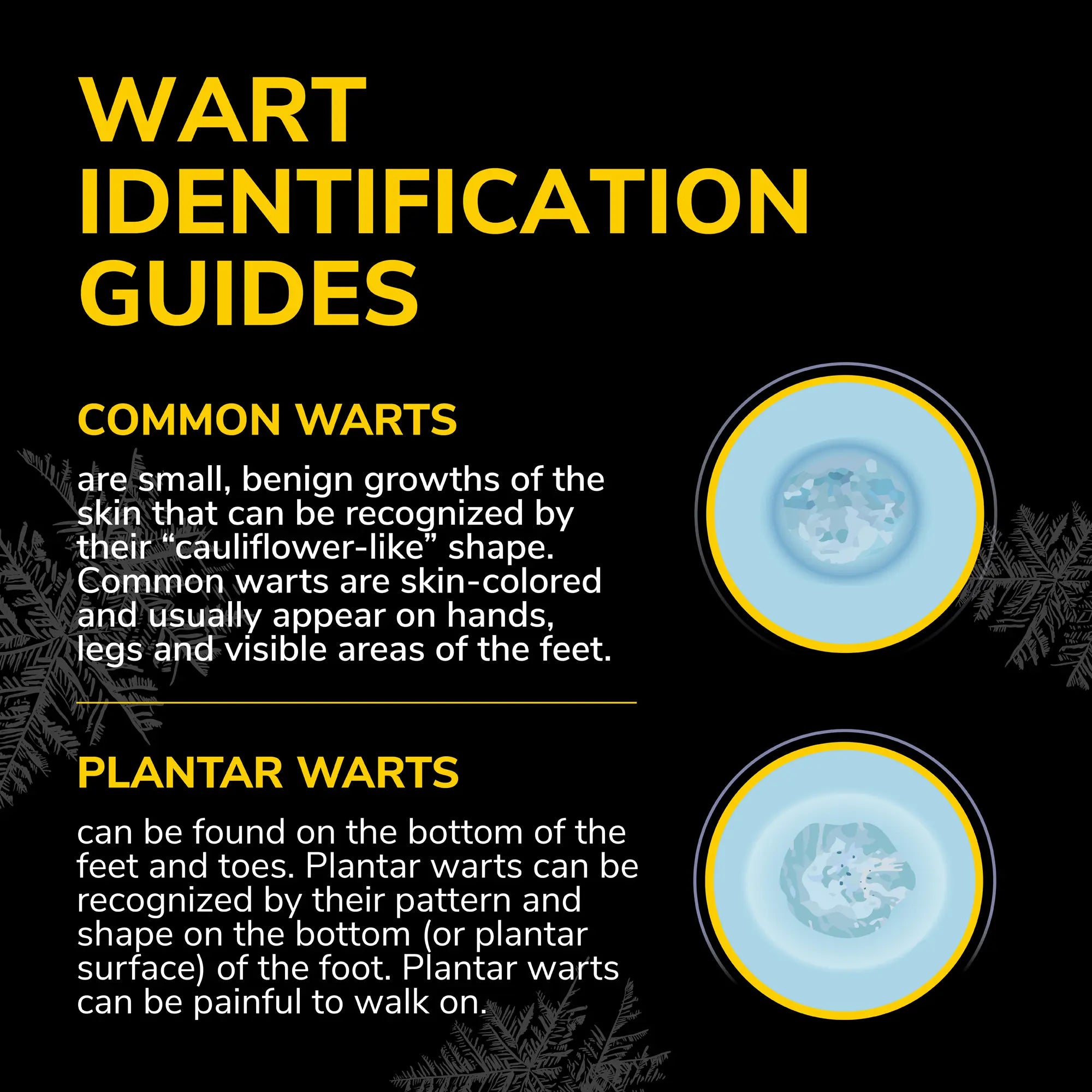 Freeze Away Max™ Wart Remover - Image 5