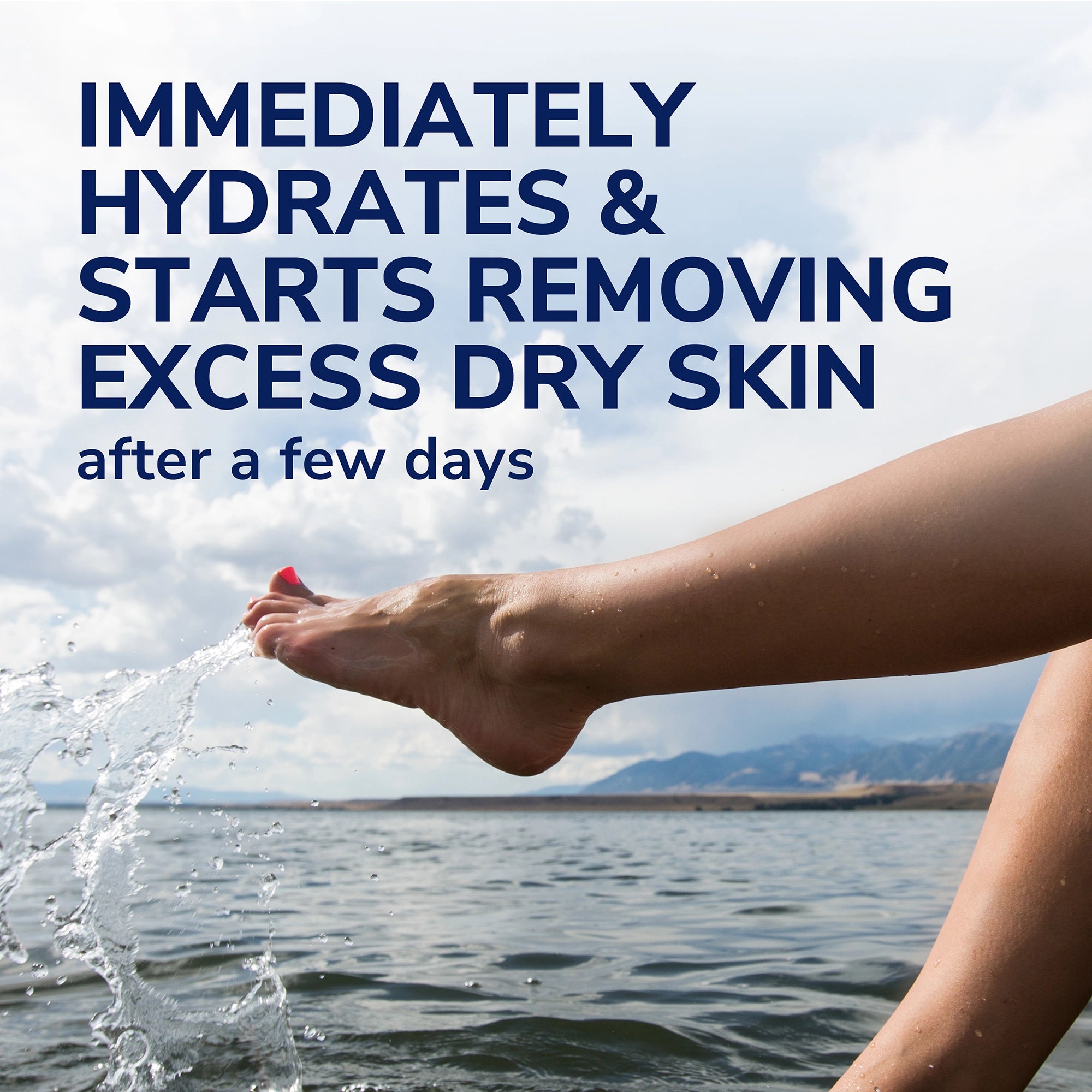 Dry, Flaky Skin Remover Ultra-Exfoliating Foot Lotion - Image 5