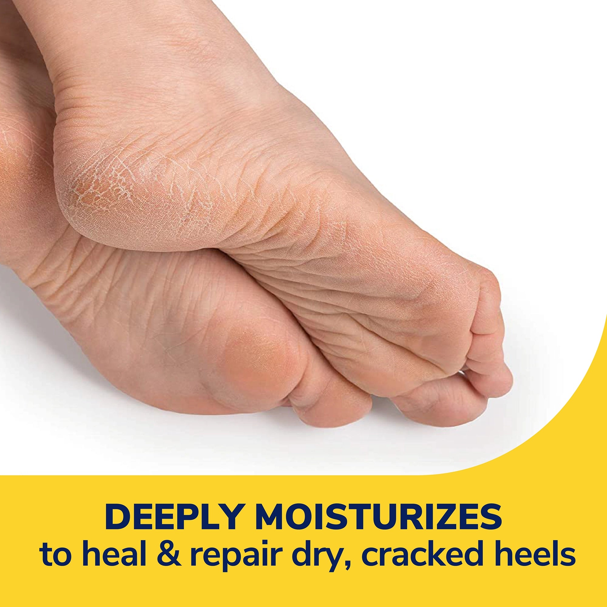 Severe Cracked Heel Repair Restoring Balm - Image 4