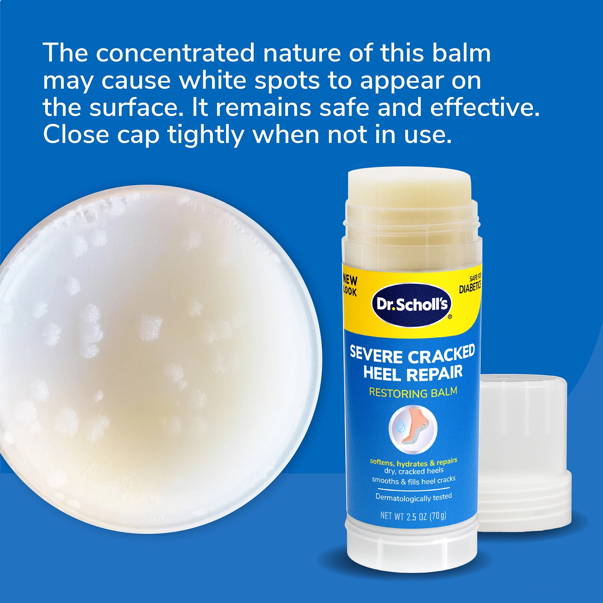 Severe Cracked Heel Repair Restoring Balm - Image 7