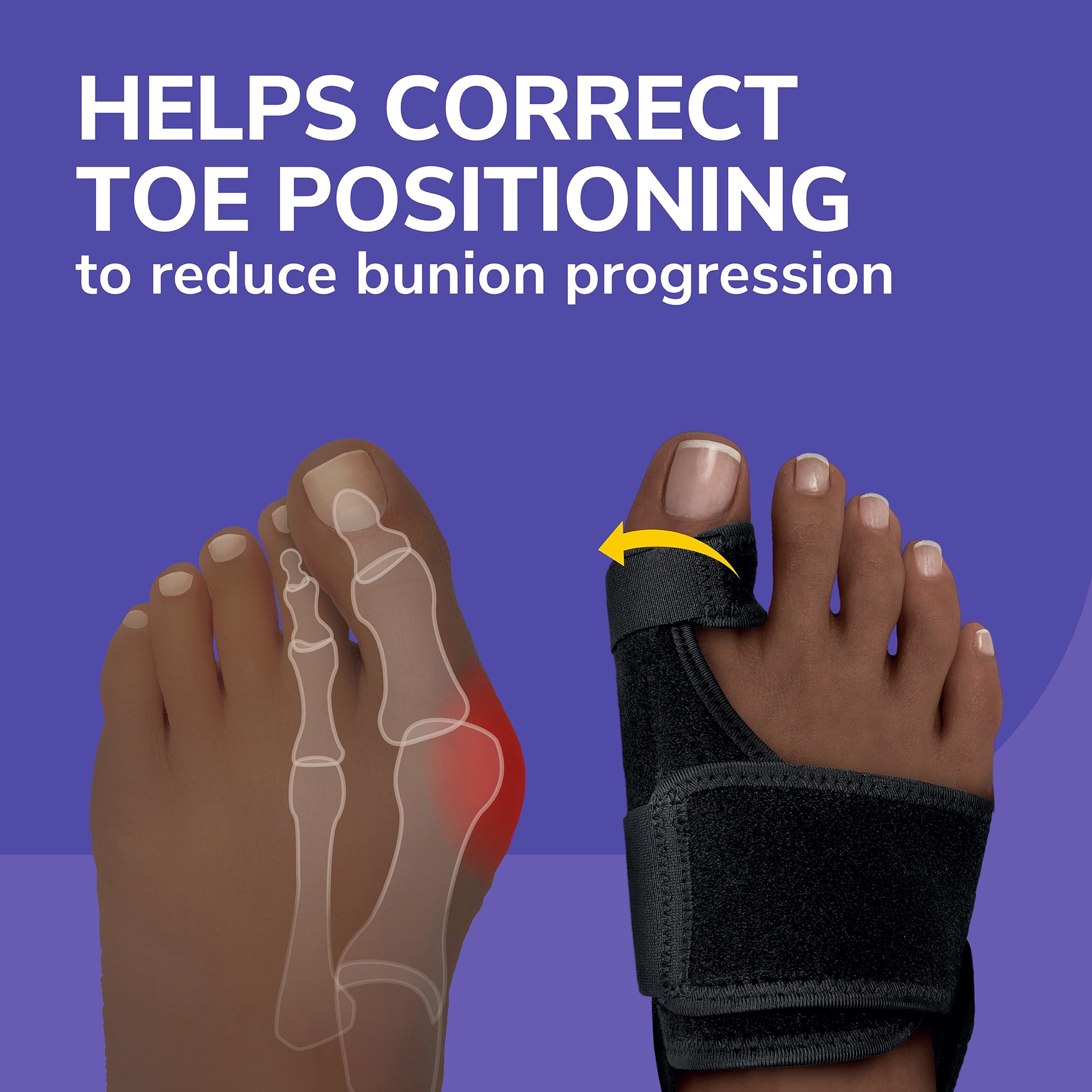 Bunion Relief & Toe Corrector - Image 2
